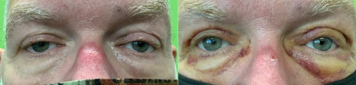 before and after 17