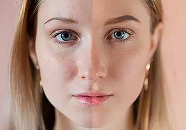 before and after example of color of face