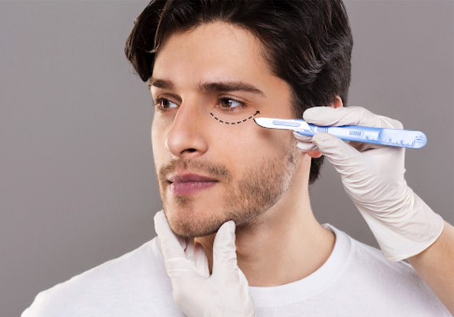 male blepharoplasty