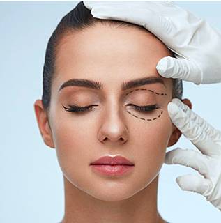 cosmetic eyelid surgery