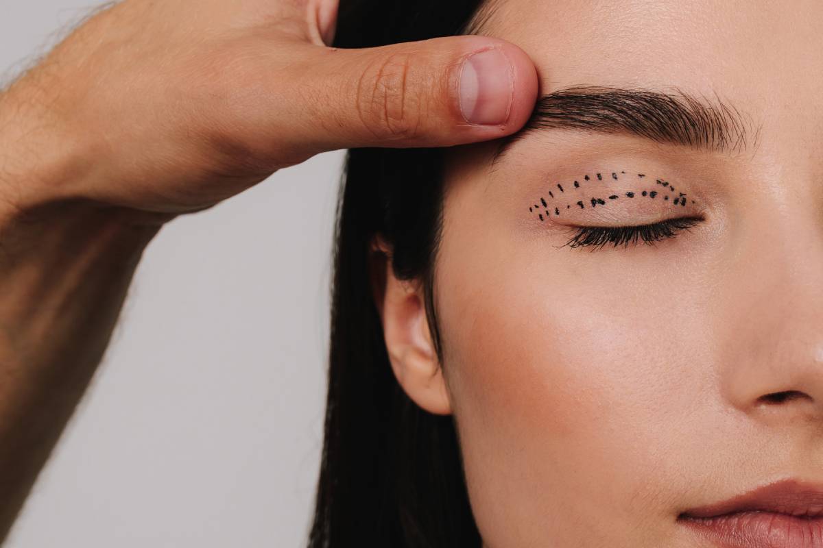 Doctor marking patient’s eyelid for blepharoplasty surgery, planning precise upper eyelid lift for smoother recovery and natural results